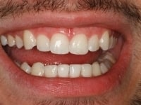 Konig Center for Cosmetic & Comprehensive Dentistry smile photos